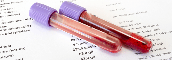 When Was the Last Time You Had a Blood Chemistry Analysis?